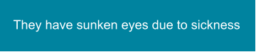 They have sunken eyes due to sickness